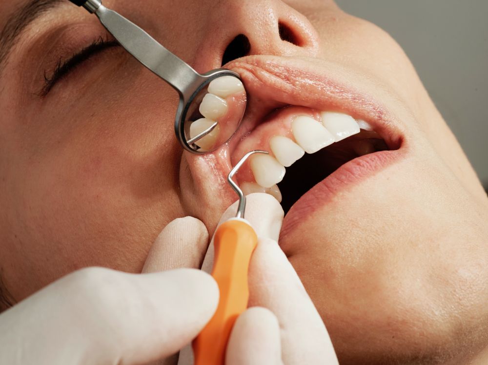 tandhygienist